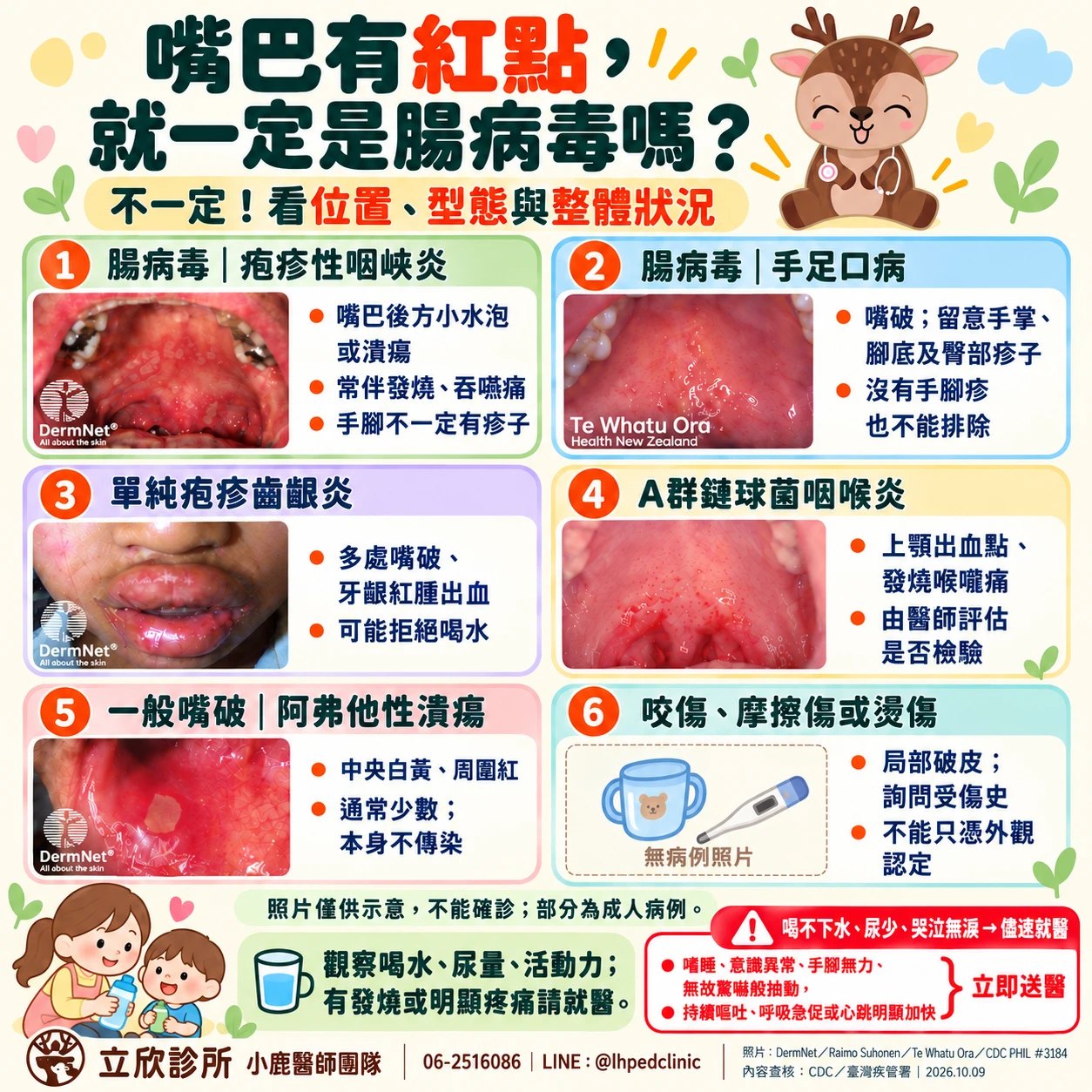 嘴巴有紅點，就一定是腸病毒嗎？不一定，看位置、型態與整體狀況——立欣診所衛教圖，以六格照片對照。1 腸病毒｜疱疹性咽峽炎：嘴巴後方小水泡或潰瘍，常伴發燒、吞嚥痛，手腳不一定有疹子。2 腸病毒｜手足口病：嘴破，留意手掌、腳底及臀部疹子，沒有手腳疹也不能排除。3 單純疱疹齒齦炎：多處嘴破、牙齦紅腫出血，可能拒絕喝水。4 A 群鏈球菌咽喉炎：上顎出血點、發燒喉嚨痛，由醫師評估是否檢驗。5 一般嘴破｜阿弗他性潰瘍：中央白黃、周圍紅，通常少數，本身不傳染。6 咬傷、摩擦傷或燙傷：局部破皮，詢問受傷史，不能只憑外觀認定。照片僅供示意，不能確診，部分為成人病例。觀察喝水、尿量、活動力，有發燒或明顯疼痛請就醫。喝不下水、尿少、哭泣無淚請儘速就醫；嗜睡、意識異常、手腳無力、無故驚嚇般抽動、持續嘔吐、呼吸急促或心跳明顯加快請立即送醫。立欣診所小鹿醫師團隊，06-2516086，LINE @lhpedclinic。