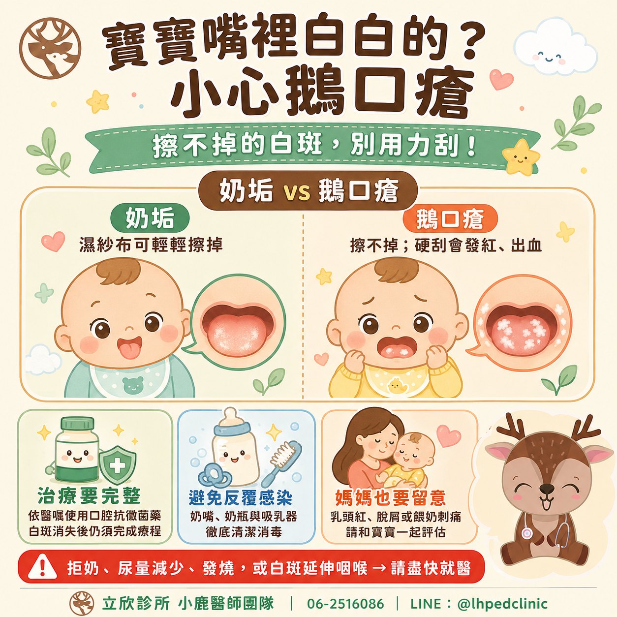 寶寶嘴裡白白的？小心鵝口瘡懶人包：①擦不掉的白斑，別用力刮；②奶垢與鵝口瘡的分辨——奶垢用濕紗布可輕輕擦掉，鵝口瘡擦不掉、硬刮會發紅出血；③治療要完整：依醫囑使用口腔抗黴菌藥，白斑消失後仍須完成療程；④避免反覆感染：奶嘴、奶瓶與吸乳器徹底清潔消毒；⑤媽媽也要留意：乳頭紅、脫屑或餵奶刺痛，請和寶寶一起評估。危險徵象：拒奶、尿量減少、發燒，或白斑延伸咽喉，請盡快就醫。